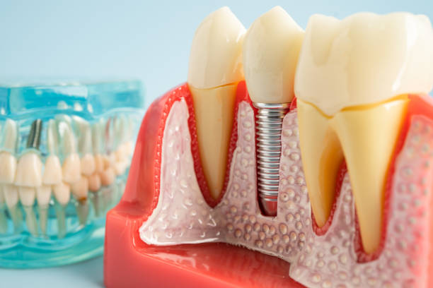 Best Oral Surgery  in Dewitt, MI